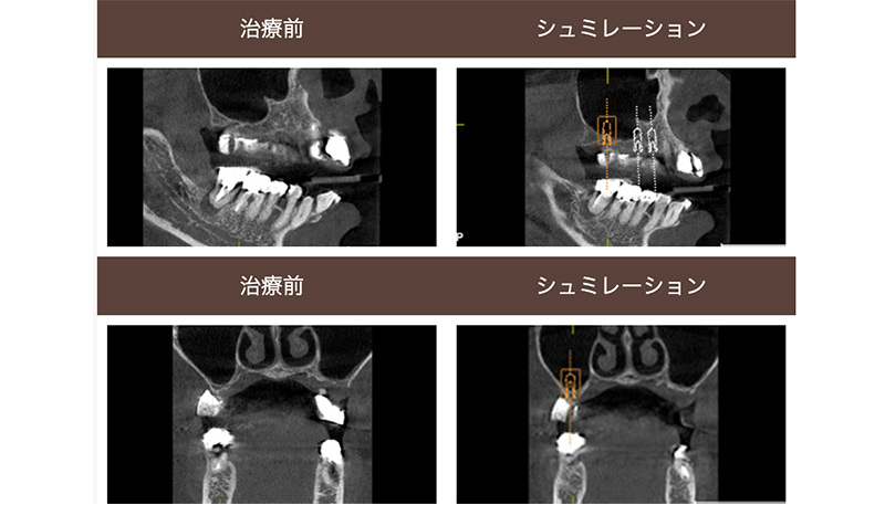 メインテナンス